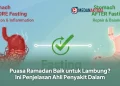 Puasa Ramadan Baik untuk Lambung? Ini Penjelasan Ahli Penyakit Dalam
